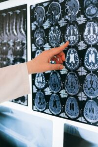 The Science of Brain Health: Strategies for Cognitive Enhancement and Mental Well-being
