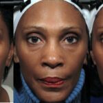 The Secret to Looking Younger Without Surgery